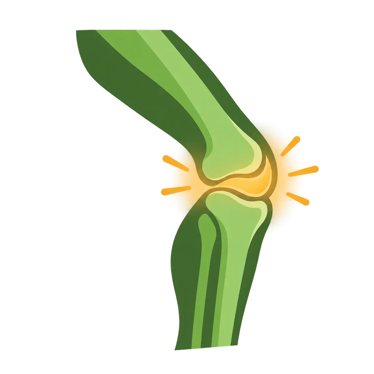 Arthritis illustration