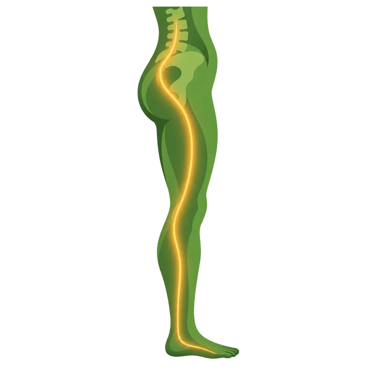 Sciatica illustration